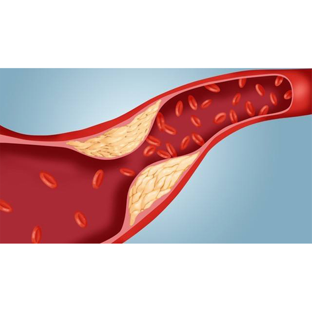 Lipidprofil